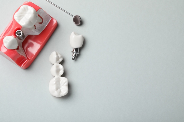 Dental Crown Used To Attach A Dental Bridge