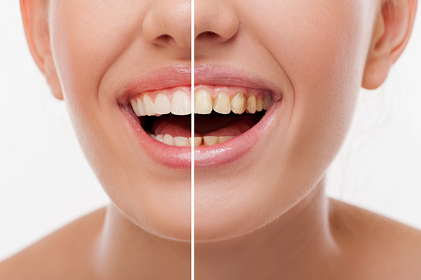 Ask a General Dentist: What Is Restorative Dentistry? from Bagnall Family Dentistry in Andover, MA