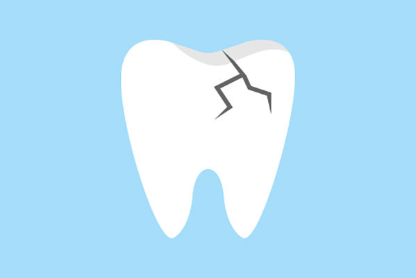 General Dentistry Restoration Options For A Damaged Tooth